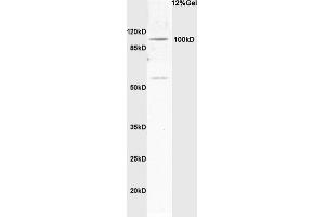 Rat brain lysates probed with Anti Synphilin-1 Polyclonal Antibody, Unconjugated (ABIN736163) at 1:200 in 4 °C. (SNCAIP 抗体  (AA 51-150))