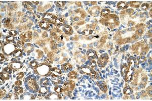 Human kidney (TAM41 抗体  (N-Term))