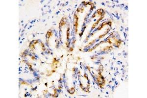 IHC-P: Calpain 1 antibody testing of rat lung tissue (CAPN1 抗体  (Middle Region))