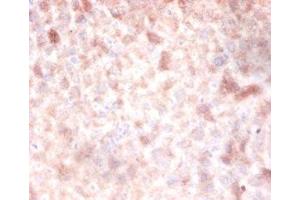 Immunohistochemistry of paraffin-embedded mouse liver tissue using ABIN7150112 at dilution of 1:100 (DNMT3A 抗体  (AA 680-902))