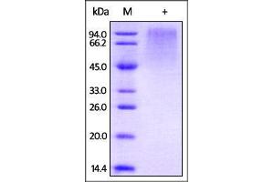 HRSV (A) glycoprotein G on SDS-PAGE under reducing (R) condition. (Glycoprotein / GP (Virus) (AA 67-297) protein (His tag))