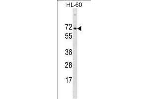 Western blot analysis in HL-60 cell line lysates (35ug/lane). (ACPL2 抗体  (AA 306-335))