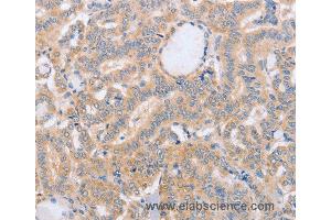 Immunohistochemistry of Human brain  using BST1 Polyclonal Antibody at dilution of 1:40 (BST1 抗体)