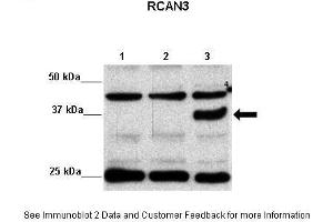 transfected HEK293 (RCAN3 抗体  (Middle Region))