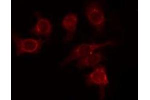 ABIN6277736 staining HepG2 by IF/ICC. (GLI1 抗体  (C-Term))