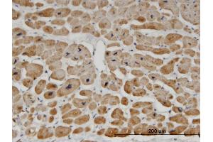 Immunoperoxidase of monoclonal antibody to ZNF239 on formalin-fixed paraffin-embedded human heart. (ZNF239 抗体  (AA 1-100))