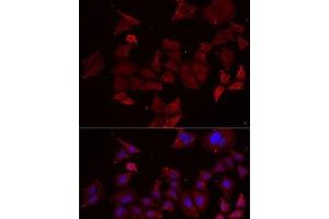 Immunofluorescence analysis of MCF7 cells using NPHP1 Polyclonal Antibody (NPHP1 抗体)