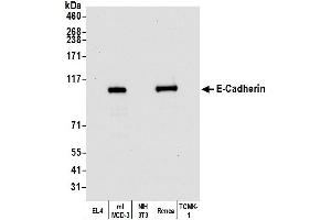 Western Blotting (WB) image for anti-Cadherin 1, Type 1, E-Cadherin (Epithelial) (CDH1) (AA 155-707) antibody (ABIN7455206)