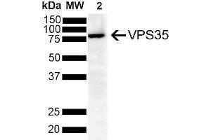 Western Blot analysis of Human SH-SY5Y showing detection of VPS35 protein using Mouse Anti-VPS35 Monoclonal Antibody, Clone 8A3 (ABIN6932977). (VPS35 抗体  (PerCP))