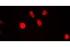 Immunofluorescent analysis of ING5 staining in A549 cells. (ING5 抗体)