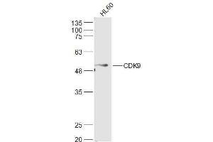 Human HL-60 lysates probed with CDK9 Polyclonal Antibody, Unconjugated  at 1:500 dilution and 4˚C overnight incubation. (CDK9 抗体  (AA 231-372))