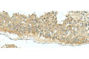 Immunohistochemistry (Paraffin-embedded Sections) (IHC (p)) image for anti-Killer Cell Immunoglobulin-Like Receptor, Two Domains, Long Cytoplasmic Tail, 5A (KIR2DL5A) antibody (ABIN7245485)