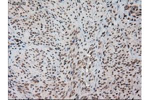 Immunohistochemical staining of paraffin-embedded kidney using anti-HES1 (ABIN2452569) mouse monoclonal antibody. (HES1 抗体  (AA 1-280))