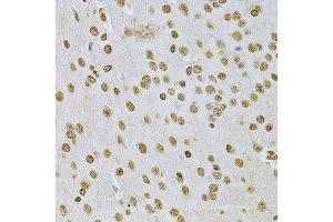 Immunohistochemistry of paraffin-embedded mouse brain using ILK Antibody.