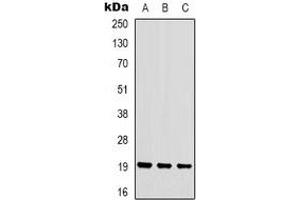 Western blot analysis of STMN1 (pS16) expression in HEK293T (A), Hela (B), Jurkat (C) whole cell lysates. (Stathmin 1 抗体  (N-Term, pSer16))