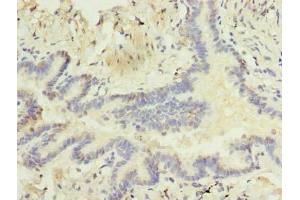 Immunohistochemistry of paraffin-embedded human lung tissue using ABIN7168256 at dilution of 1:100 (RNF24 抗体  (AA 45-148))