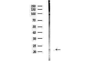 anti-Fibroblast Growth Factor 7 (FGF7) (Internal Region) antibody