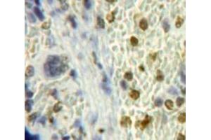 #VALUE! (Inhibitory Subunit of NF-KappaB zeta (AA 414-654) 抗体)