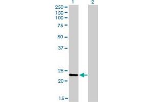 Western Blotting (WB) image for anti-RAB9A, Member RAS Oncogene Family (RAB9A) (AA 17-115) antibody (ABIN564041)