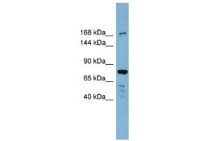 DAPK1 antibody used at 1 ug/ml to detect target protein. (DAP Kinase 1 抗体  (N-Term))