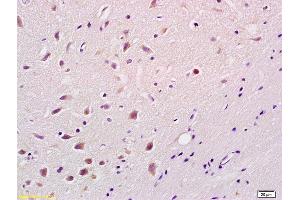Formalin-fixed and paraffin embedded rat brain labeled with Rabbit Anti phospho-Bim(Ser87) Polyclonal Antibody, Unconjugated (ABIN682873) at 1:200 followed by conjugation to the secondary antibody and DAB staining (BIM 抗体  (pSer87))
