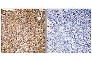 Immunohistochemistry (IHC) image for anti-Phosphoinositide-3-Kinase, Catalytic, gamma Polypeptide (PIK3CG) (Internal Region) antibody (ABIN1852676) (PIK3 gamma 抗体  (Internal Region))