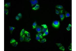 Immunofluorescence staining of Hela cells with ABIN7168815 at 1:33, counter-stained with DAPI. (SEMA5B 抗体  (AA 845-1013))