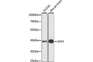 Western blot analysis of extracts of various cell lines, using SDF4 antibody (ABIN7270606) at 1:1000 dilution. (SDF4 抗体  (AA 37-200))