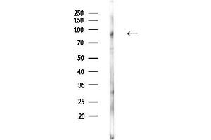 anti-ADAM Metallopeptidase Domain 30 (ADAM30) (Internal Region) antibody