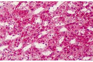 Human Adrenal: Formalin-Fixed, Paraffin-Embedded (FFPE) (PPARG 抗体  (Internal Region))