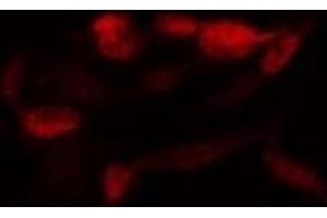 ABIN6278347 staining  MDA-MB-435 cells by IF/ICC. (SENP2 抗体)