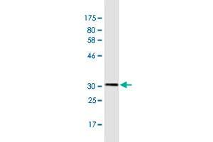 Western Blotting (WB) image for anti-Transient Receptor Potential Cation Channel, Subfamily C, Member 1 (TRPC1) (AA 442-505) antibody (ABIN1327298)