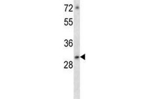 ATF5 antibody western blot analysis in MCF-7 lysate (ATF5 抗体  (AA 188-216))