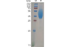 SDS-PAGE (SDS) image for Carcinoembryonic Antigen-Related Cell Adhesion Molecule 6 (CEACAM6) (AA 35-320) protein (His tag) (ABIN6964142)