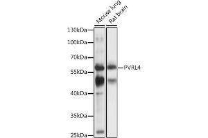Western blot analysis of extracts of various cell lines, using PVRL4 antibody (ABIN7269433) at 1:1000 dilution. (PVRL4 抗体  (AA 371-510))