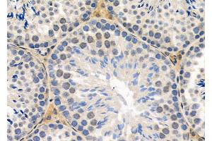 ABIN6260374 and ABIN6279100 at 1/100 staining Mouse testis tissue by IHC-P. (RPP25L 抗体  (C-Term))