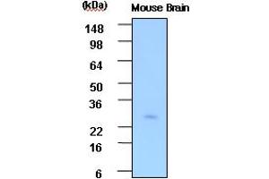 Western blot analysis: Cell lysates of Mouse brain(30ug) were resolved by SDS-PAGE, transferred to PVDF membrane and probed with anti-human PSP (1:1000).