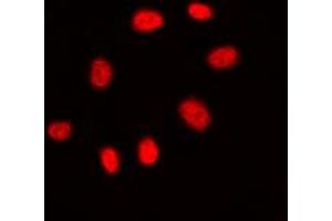 Immunofluorescent analysis of CDC25C staining in A431 cells. (CDC25C 抗体  (Center))