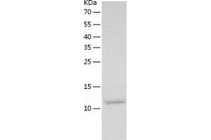 Lectin, Galactoside-Binding, Soluble, 1 (LGALS1) (AA 1-135) protein (His-IF2DI Tag)