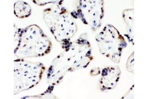 IHC analysis of CCT3 using anti-CCT3 antibody (ABIN4886513).