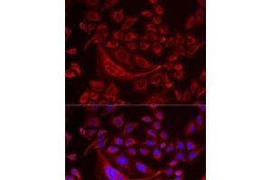 Immunofluorescence analysis of MCF7 cells using TUFM Polyclonal Antibody (TUFM 抗体)