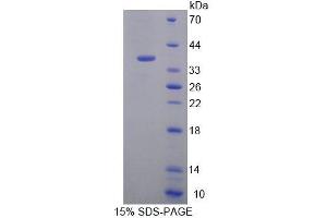 SDS-PAGE analysis of Human EEF1d Protein. (EEF1D 蛋白)
