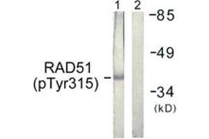 Western blot analysis of extracts from Jurkat cells, using RAD51 (Phospho-Tyr315) Antibody. (RAD51 抗体  (pSer315))