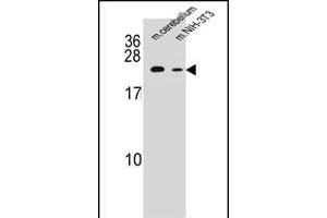 RAB12 Antibody (N-term) (ABIN655307 and ABIN2844889) western blot analysis in mouse cerebellum tissue and mouse NIH-3T3 cell line lysates (35 μg/lane). (RAB12 抗体  (N-Term))