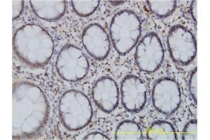 Immunoperoxidase of monoclonal antibody to SPAST on formalin-fixed paraffin-embedded human colon. (Spastin 抗体  (AA 200-304))