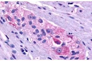 Immunohistochemical staining of human colon with PROKR1 polyclonal antibody .