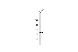 Anti-ALKBH8 Antibody (C-term) at 1:1000 dilution + Jurkat whole cell lysate Lysates/proteins at 20 μg per lane. (ALKBH8 抗体  (C-Term))