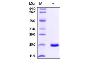Human NME1, His Tag on SDS-PAGE under reducing (R) condition. (NME1 Protein (AA 2-152) (His tag))