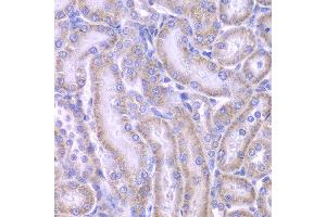 Immunohistochemistry of paraffin-embedded rat kidney using ACAA1 antibody at dilution of 1:100 (x400 lens). (ACAA1 抗体)