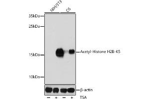 Western blot analysis of extracts of various cell lines, using Acetyl-Histone H2B-K5 antibody (ABIN7267733) at 1:1000 dilution. (Histone H2B 抗体  (acLys5))